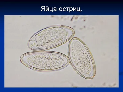 Противоглистное средство Oxford Пирантел суспензия - «Покажу как выглядят  острицы. Как мы выводили острицы. Дам советы как избавиться от глистов,  если лечение не дает эффекта. Расскажу способ как отловить остриц, если  анализ