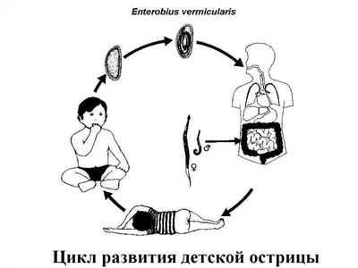 Как Избавиться от Глистов(Остриц), Быстро и Эфективно в Домашних  условиях... | Доктор Жирафик | Дзен