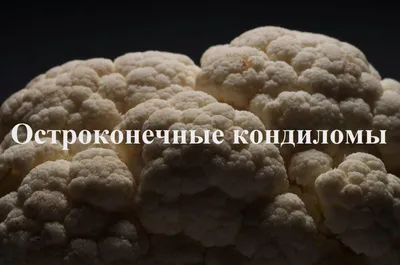 Как определить – бородавка или нет? ✓ Авторские статьи Клиники подологии  Полёт в Москве