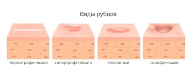 Зуд в интимной зоне у женщин - Клиника Марины Рябус