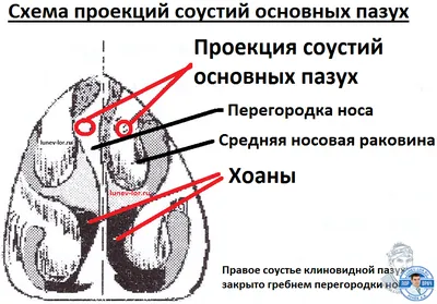 Патология полости носа и околоносовых пазух, ассоциированная с  гастроэзофагеальной рефлюксной болезнью – тема научной статьи по  клинической медицине читайте бесплатно текст научно-исследовательской  работы в электронной библиотеке КиберЛенинка