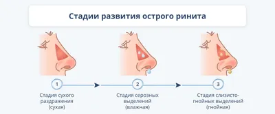 Спрей назальный Boehringer Ingelheim Лазолван Рино - «Спас меня и мой нос  от сильнейшего ОТЕКА СЛИЗИСТОЙ! Самый лучший спрей от насморка!» | отзывы