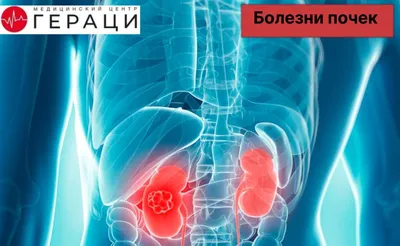 Болезнь почек - Причины и профилактика | Fresenius Medical Care