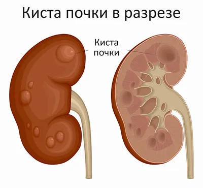 Отеки ног – это симптом с выраженным увеличением межтканевой жидкости в  нижних конечностях