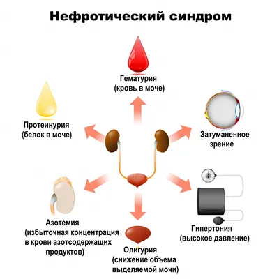 Отеки ног: 11 причин. Как самостоятельно разобраться - YouTube