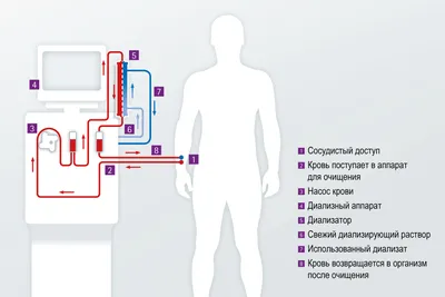 💊 ОТЕКИ. КАК УБРАТЬ ОТЕКИ И СНИЗИТЬ ВЕС? ПРИЧИНЫ ОТЕКОВ, ЛЕЧЕНИЕ. Врач  эндокринолог Ольга Павлова. - YouTube