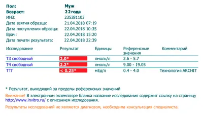 Почему отекают ноги. Отек голени или щиколотки - к какому врачу обращаться?