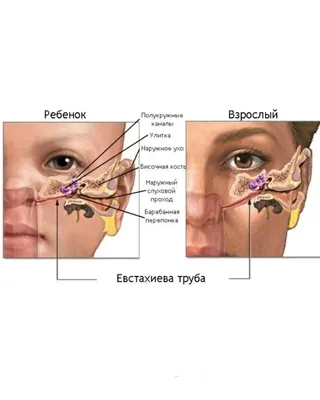 Отит - лечение и симптомы у взрослых и детей: причины и меры профилактики