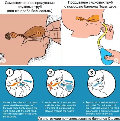 Отит у ребенка. Что делать? | Доктор Юлия | Дзен