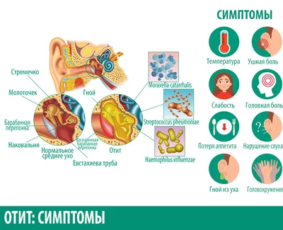 Отит у взрослого - статьи от компании Еламед