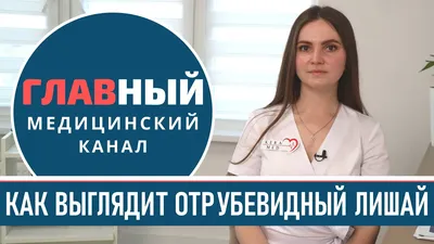 Лишай: причины, симптомы, диагностика и лечение болезни