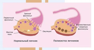 Что такое овуляция?