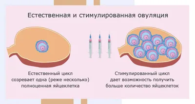 Типичные признаки того, что у вас наступила овуляция | О здоровье простыми  словами | Дзен