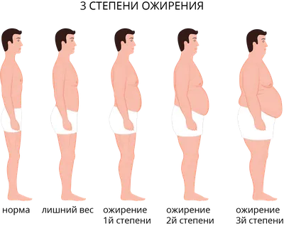 Абдоминальное ожирение - что это такое, причины, виды, симптомы,  диагностика и лечение