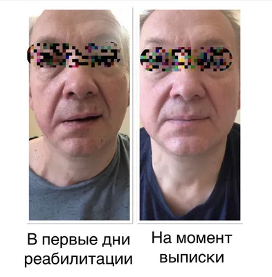 Метод Герасимова: как гений пластической реконструкции вернул Ушакову лицо,  а Германии — Шиллера