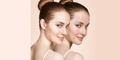 ≡ Золотая маска-пленка для лица Skinlite Обновление кожи, 15 г в Киеве,  цена, отзывы — Naomi24.ua