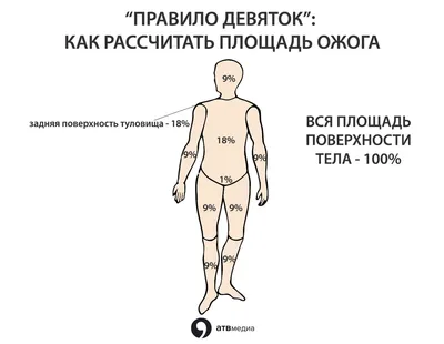 ОБЪЕДИНЕНИЕ КОМБУСТИОЛОГОВ «МИР БЕЗ ОЖОГОВ»Применение региональной  лимфатической антибиотикотерапии при местном лечении пострадавших от ожогов  » ОБЪЕДИНЕНИЕ КОМБУСТИОЛОГОВ «МИР БЕЗ ОЖОГОВ»