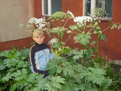 Ожог от борщевика: чем лечить, симптомы, первая помощь: Уход за собой:  Забота о себе: Lenta.ru