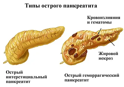 Заболевания поджелудочной железы у животных