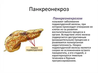 Панкреонекроз - причины, диагностика и лечение в лучших клиниках - MedTour