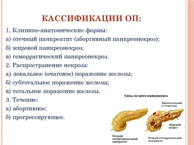 PPT - Острый панкреатит PowerPoint Presentation, free download - ID:3411670