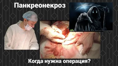 Dr.Sokolinskiy - ПАНКРЕОНЕКРОЗ. Что важно знать. Поговорим о важных  моментах, связанных с панкреонекрозом, но взглядом натуропатии -  восстановление саморегуляции работы поджелудочной железы. Панкреонекроз -  это тяжелая степень разрушения поджелудочной ...