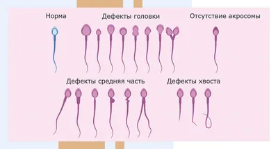 Что такое ВПЧ, симптомы и факторы развития болезни — полезная информация на  сайте медицинского центра Мой доктор