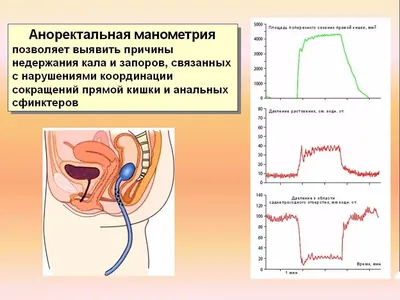 Вопросы проктологу: что лечит, как подготовиться к приёму, последствия  анального секса