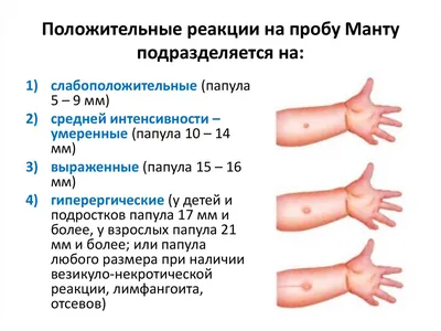 Папулы росли и чесались, это был кошмар»: жительница Новосибирска  заработала отек Квинке после мезотерапии - KP.RU