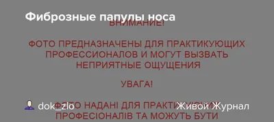 Папулы И Бляшки. Поражение Кожи. Папулы Представляет Собой Твердый  Возвышение Кожи И Накопление Материала В Дерме Без Видимых Дефектов  Жидкости. Зубной Налет - Слияние Папул Клипарты, SVG, векторы, и Набор  Иллюстраций Без