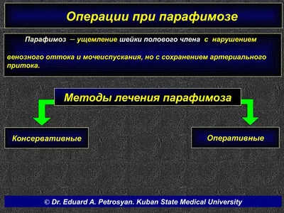 ФИМОЗ Фимоз - это сужение отверстия крайней плоти, препятствующее обнажению  головки пениса. Фимоз.. | ВКонтакте