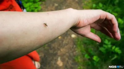 Диагностика и лазерное удаление личинок червей внутри кожи в Алматы, цена,  отзывы — MLC