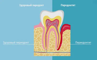 Лечение пародонтита цены Vector Москва метро Полянка стоматология