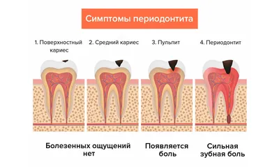 Болезнь зубов: Пародонтит — Стоматология «Доктор НеболитЪ»