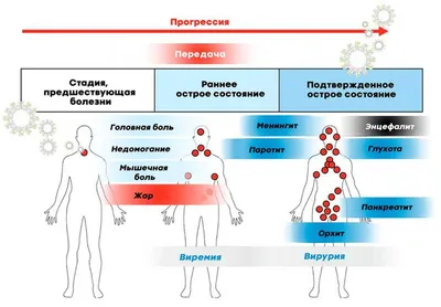 Эпидемический паротит: причины появления, симптомы, диагностика и способы  лечения | 08.08.2023 | Новости Хасавюрта - БезФормата