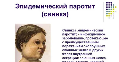 ⭕️Епідемічний паротит⭕️ ▪️Це гостре висококонтагіозне інфекційне  захворювання, яке характеризується гарячкою, загальною інтоксикацією… |  Instagram