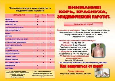 Детские вирусные инфекции. Эпидемический ПАРОТИТ (свинка) — Светлогорский  зональный ЦГЭ