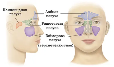 Острый синусит. Симптомы, диагностика, лечение - Доказательная медицина для  всех