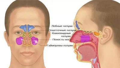 Гайморит: симптомы, причины, диагностика и лечение | Блог ЛДЦ Здоровье