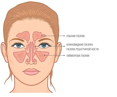 Затяжной риносинусит: симптомы и лечение