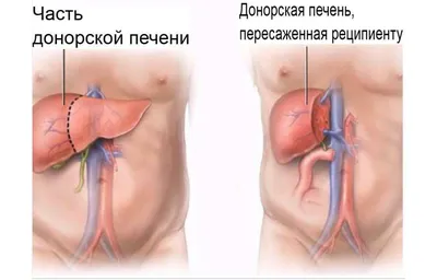 Московские ученые создали модель печени человека для обучения врачей