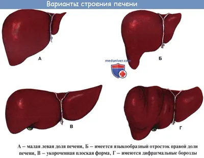 Asclepius Med Service - 🇮🇳🏥Пересадка печени или Трансплантация печени-  это когда больная печень пациента полностью заменяется цельной или частично  здоровой печенью у другого человека. 🇮🇳Медцентры Индии показывают  великолепные результаты в области ...