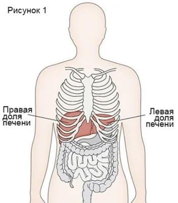 Больная печень PNG , печень, Всемирный день борьбы с гепатитом, Болезнь  печени PNG картинки и пнг PSD рисунок для бесплатной загрузки