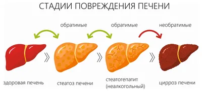 Гепатолог перечислила неочевидные симптомы цирроза печени: Питание и сон:  Забота о себе: Lenta.ru