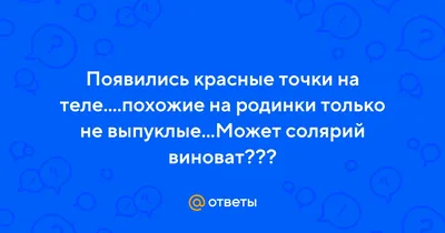Ответы Mail.ru: Появились красные точки на теле....похожие на родинки  только не выпуклые...Может солярий виноват???