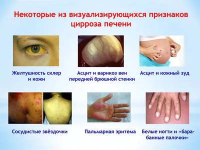 Uzbek Medical on X: \"Клотримазол; Клотримазол; мазь; на русском;  Clotrumazolum https://t.co/0QbVU8lfXA\" / X