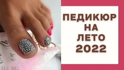 10 идей классного летнего педикюра 2022