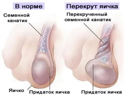 Профилактика мужского бесплодия с помощью солнечного света | Клиника  оперативной урологии и андрологии «Андролог03»