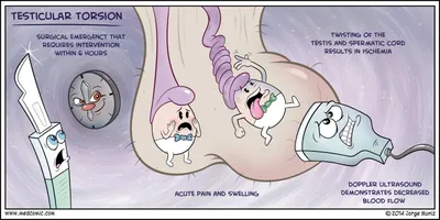 Перекрут яичка — опасная ситуация, которая требует немедленной помощи.  Может быть в любом возрасте, даже внутриутробно, но чаще возникает… |  Instagram