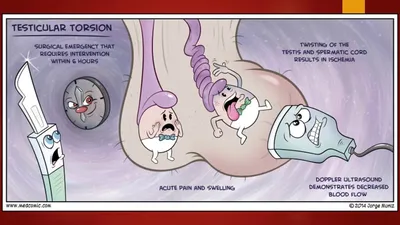 УЗ-диагностика перекрута яичка. УЗИ в урологии-2020 (минисерии) Станислав  Феданов - YouTube